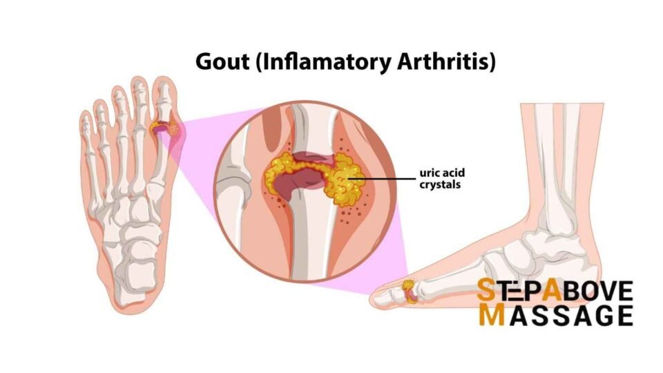massage gout massage gout