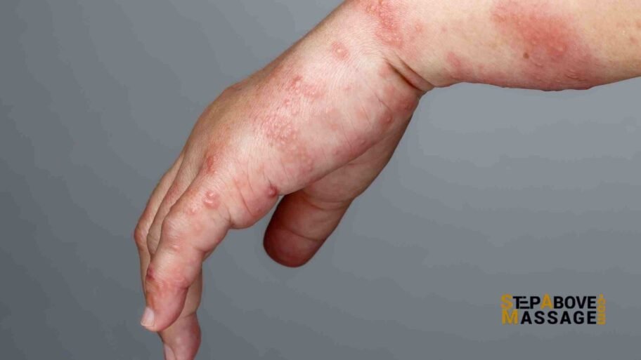 ganglion cyst ganglion cyst