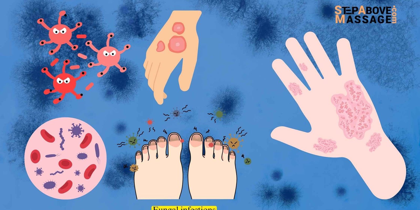 Essential Oils to Prevent Fungal Infections