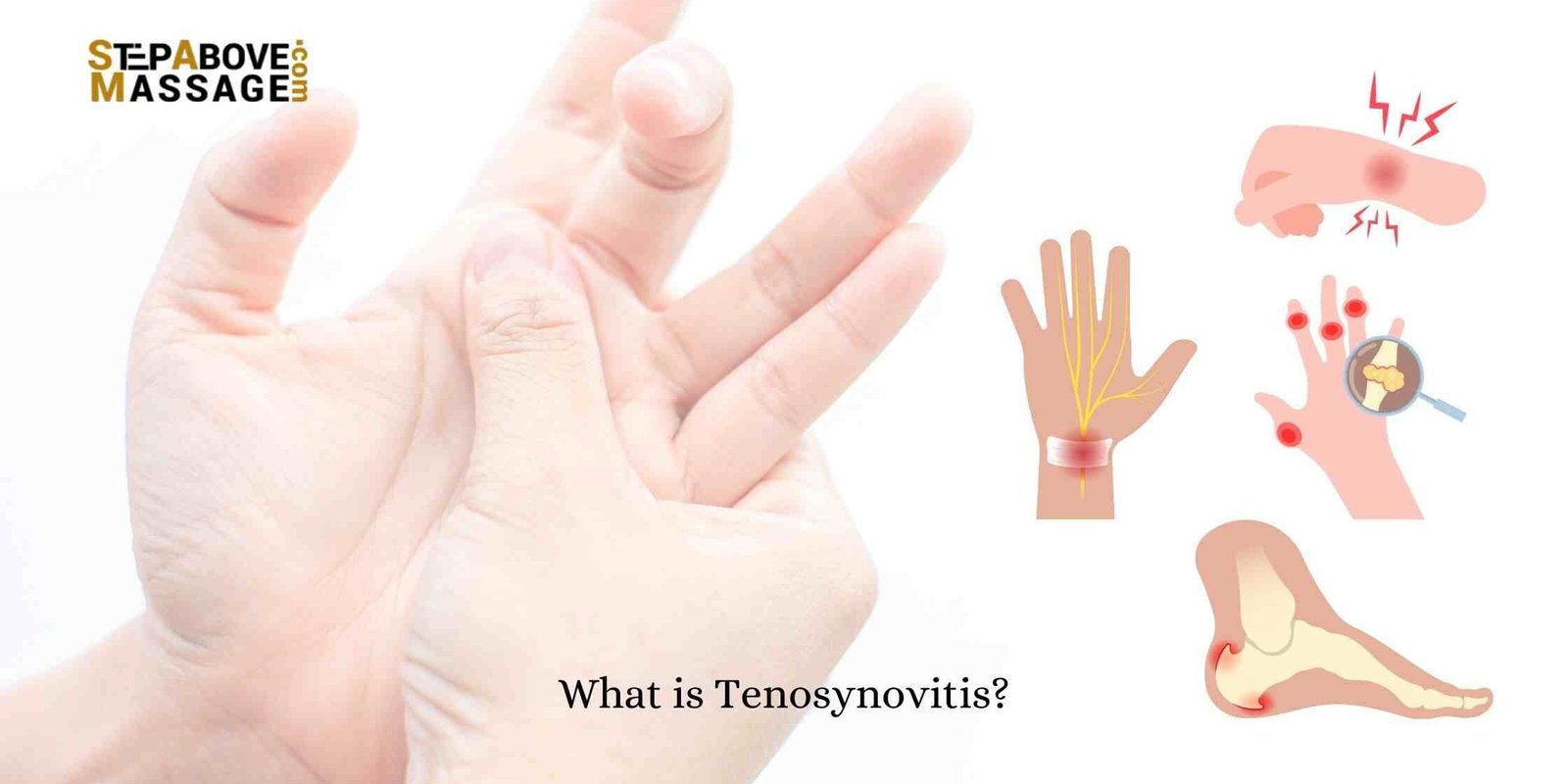 what is tenosynovitis