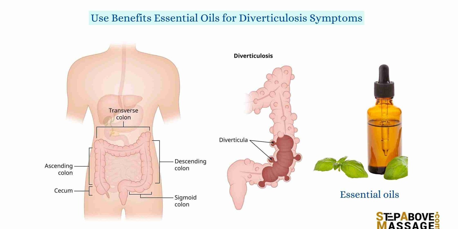 essential oils for diverticulosis