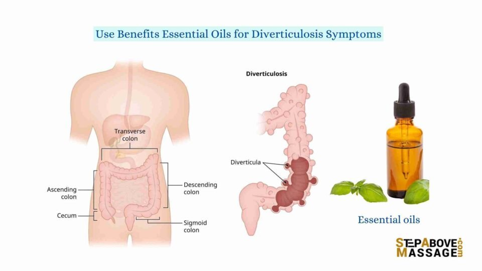 essential oils for diverticulosis