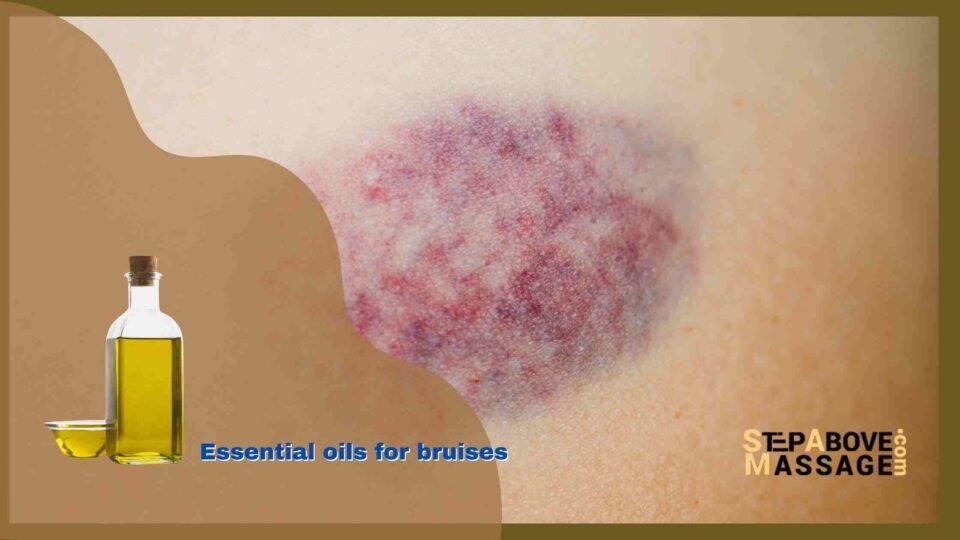 essential oils for bruises
